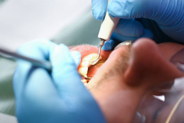 Best Emergency Dental Services for Seniors in New Madison, OH