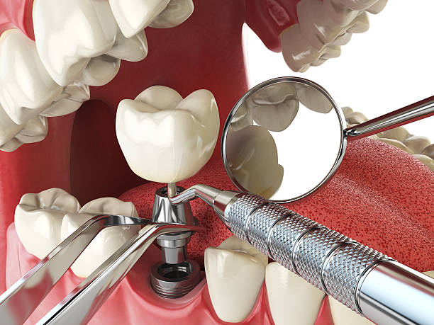 Best Broken or Cracked Tooth Emergency Dentist in New Madison, OH