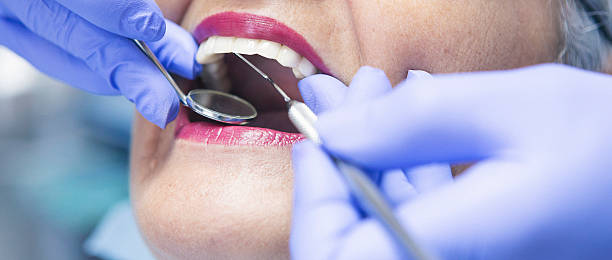 Best Emergency Dental Care for Abscessed Tooth in New Madison, OH